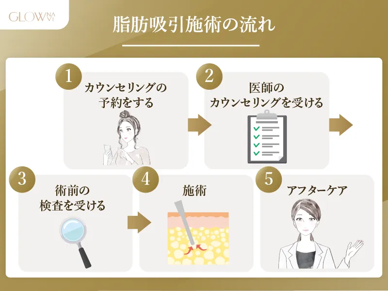 脂肪吸引　施術の流れ